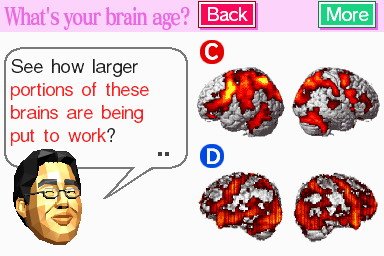 Brain-age-2